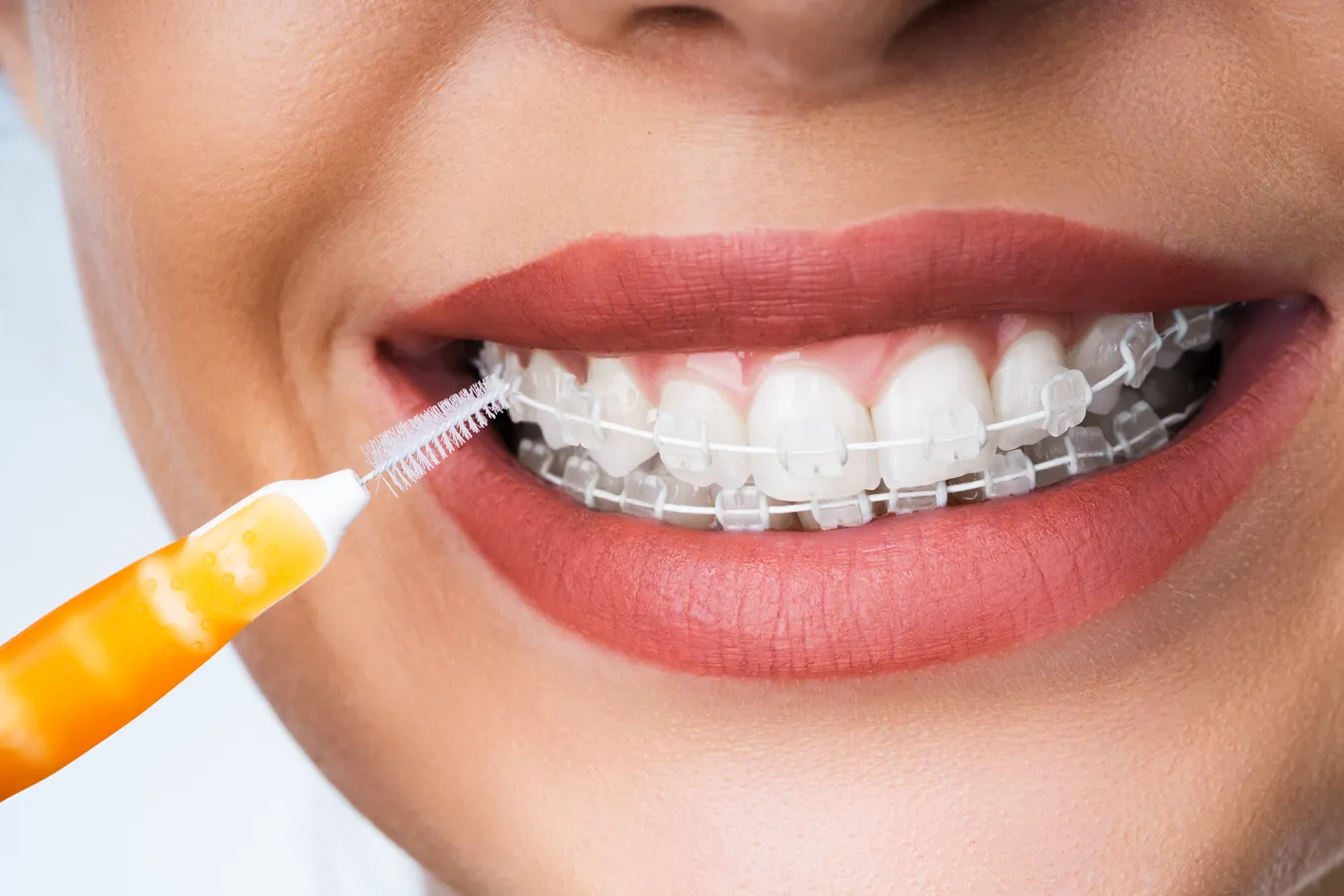 Protetyka 3d Warszawa