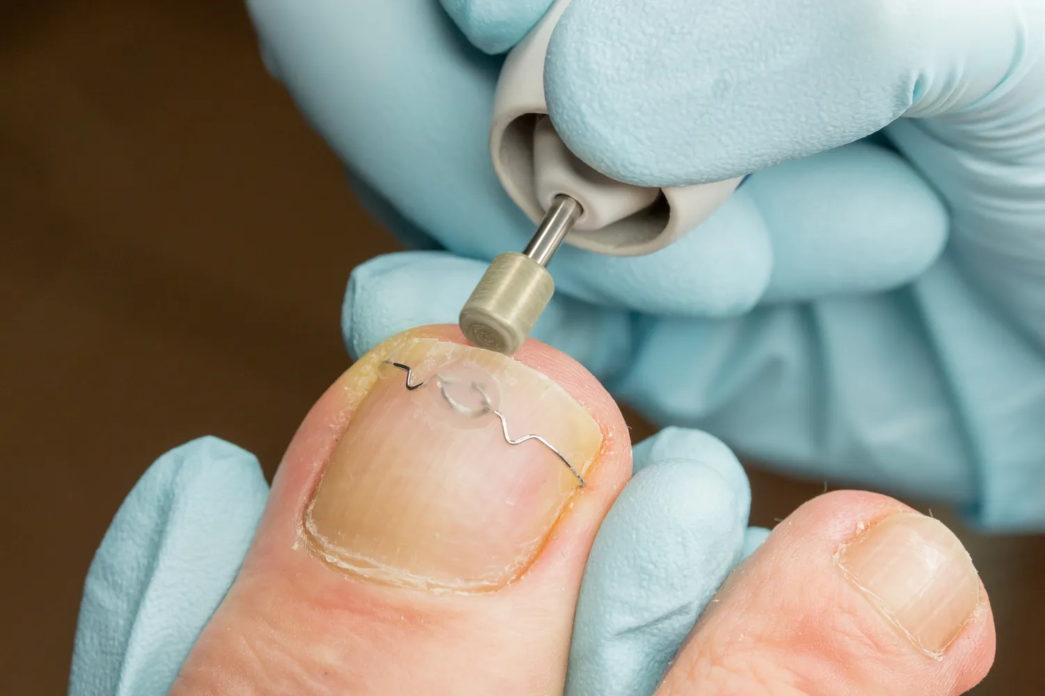 Gabinet podologiczny Warszawa